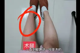 髋关节置换术后39天，个人症状描述（因人而异仅供参考）