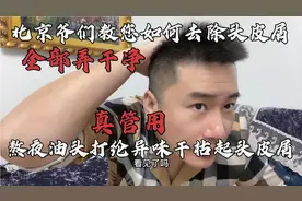 北京爷们教您如何去除头皮屑，熬夜油头干枯打纶起头皮屑，管用！视频封面