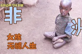 非洲8岁女孩患肌无力，从小就不能走路，家里每天只能吃一餐饭视频封面