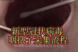 【医学视频】新型冠状病毒咽拭子采集流程