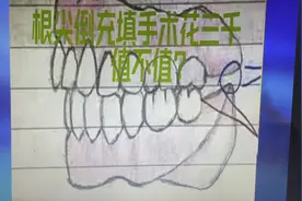 你愿意花三千块做根尖倒充填手术？用于根管治疗后，牙齿仍不好视频封面