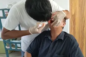 小伙一天就能做好的半口假牙，从取模，制作，戴牙，全程无尿点！视频封面