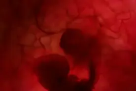 世界首列男性怀孕生子视频封面