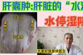 桂枝茯苓丸合用:治疗肝囊肿视频封面