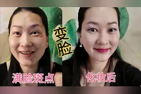 女人满脸长斑怎么出门？5分钟化妆，像变了个人，老公直呼神奇