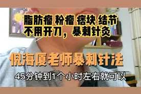 倪海厦老师暴刺针灸实战，花生米大小脂肪瘤，一次针灸基本消失。视频封面