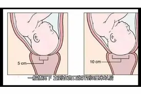 宫口什么时候会打开？宫口开了就一定会生吗？如何判断自己宫口开