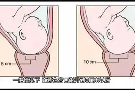 宫口什么时候会打开？宫口开了就一定会生吗？如何判断自己宫口开视频封面