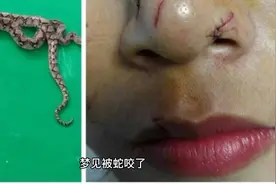 梦见被蛇咬了的预示视频封面