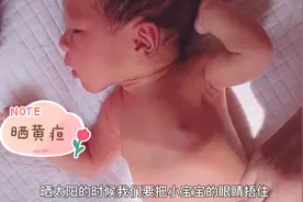 如何简单有效的正确晒黄疸，你学会了吗？视频封面