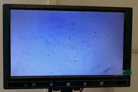 福建慢性前列腺炎病友，症状消失，基本治愈了，卵磷脂小体4+视频封面