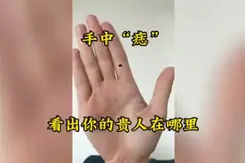你手上有这种痣吗？视频封面