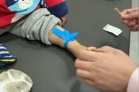 脚背静脉输液及固定视频封面