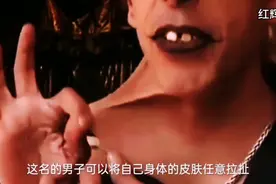 世界上皮肤最有弹性的人