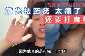 激光祛跖疣有一个月了，现在伤口愈合怎么样了激光祛跖疣能根治吗视频封面