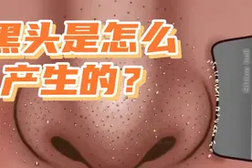 黑头是怎么产生的？80%的人不知道视频封面