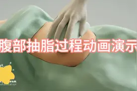腹部抽脂过程动画演示，你敢抽吗？视频封面