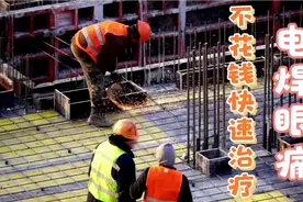 快速治疗电焊眼痛的方法，竟然可以这样，平时都不知道。视频封面