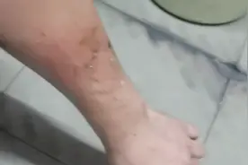 千万不要相信网上的所谓除胶神器，一招教你让你轻松解决！