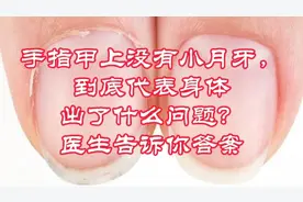 手指甲上没有小月牙，到底代表身体出了什么问题？医生告诉你答案视频封面
