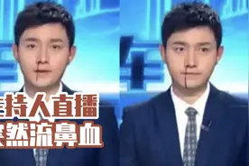 主持人直播中流鼻血，依然淡定播报，作为同行怎么看？视频封面