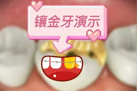 镶金牙动画演示，隔着屏幕都疼视频封面