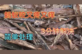 被红蚂蚁咬后又疼又痒！一个简单方便处理就能完美解决