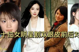 十位女明星割双眼皮前后大对比视频封面