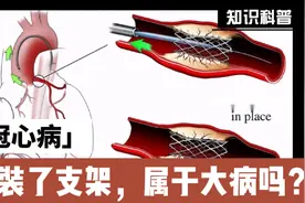 冠心病，装了支架，属于严重疾病吗？视频封面