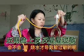 到浙江半个月，脸上反反复复经常过敏，马东梅实在受不了想回贵州视频封面