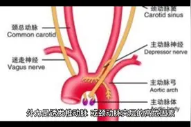 外力是诱发椎动脉或颈动脉来层的高危因素视频封面