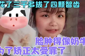 为了矫正花了三千多拔了四颗智齿，脸肿得像奶牛，太受罪了。视频封面
