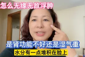 脸怎么无缘无故肿了，吓得赶紧去医院做检查，结果…视频封面