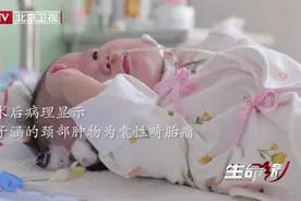 4个月大女婴颈部长有巨大肿物，医生的坚持让孩子得以重生！视频封面