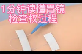 一分钟读懂胃镜检查过程