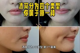 酒窝分为四个类型，你属于哪一种？