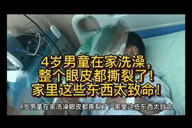 4岁男童在家洗澡，整个眼皮都撕裂了！家里这些东西太致命！