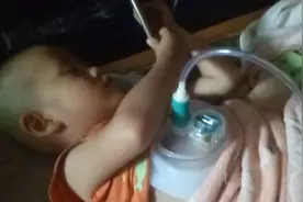每天我的任务就是帮儿子做吸胸治疗视频封面