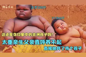 被亲生父亲抛弃，非洲男孩五岁体重高达200斤，好在养父不离不弃视频封面