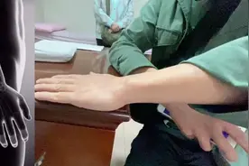 手腕扭伤疼痛很久手法快速解除视频封面