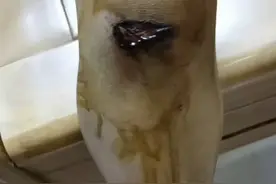 小孩跌伤大出血用这药油真的三天就好了，还不畄疤痕真的是OK。视频封面