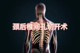 颈椎病的手术治疗演示，值得收藏！视频封面