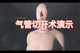 高清动画演示气管切开术！