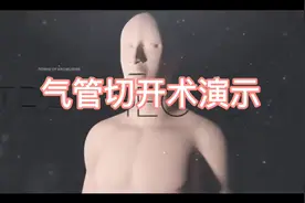 高清动画演示气管切开术！视频封面