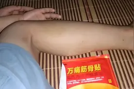 不小心撞淤青了怎麼辦，用這個便宜又好用，用了兩天淤青就散了