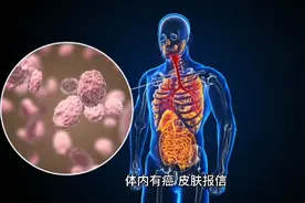 体内有癌，皮肤报信？医生提醒：3个部位瘙痒，可能是癌细胞苏醒视频封面