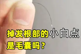 掉发根部的小白点是毛囊吗？视频封面