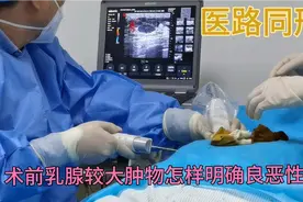 简单易行 轻松诊断乳腺肿物良恶性视频封面