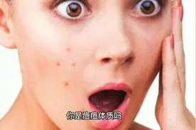 痘痘特效药！三天消除痘痘，方法竟然如此简单！视频封面