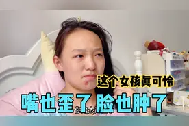 14岁女孩下巴长了火疖子，嘴巴也歪了，脸也肿了，医生说是感染了视频封面